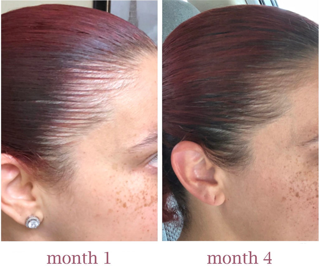 Hair Growth Serum - Roll On