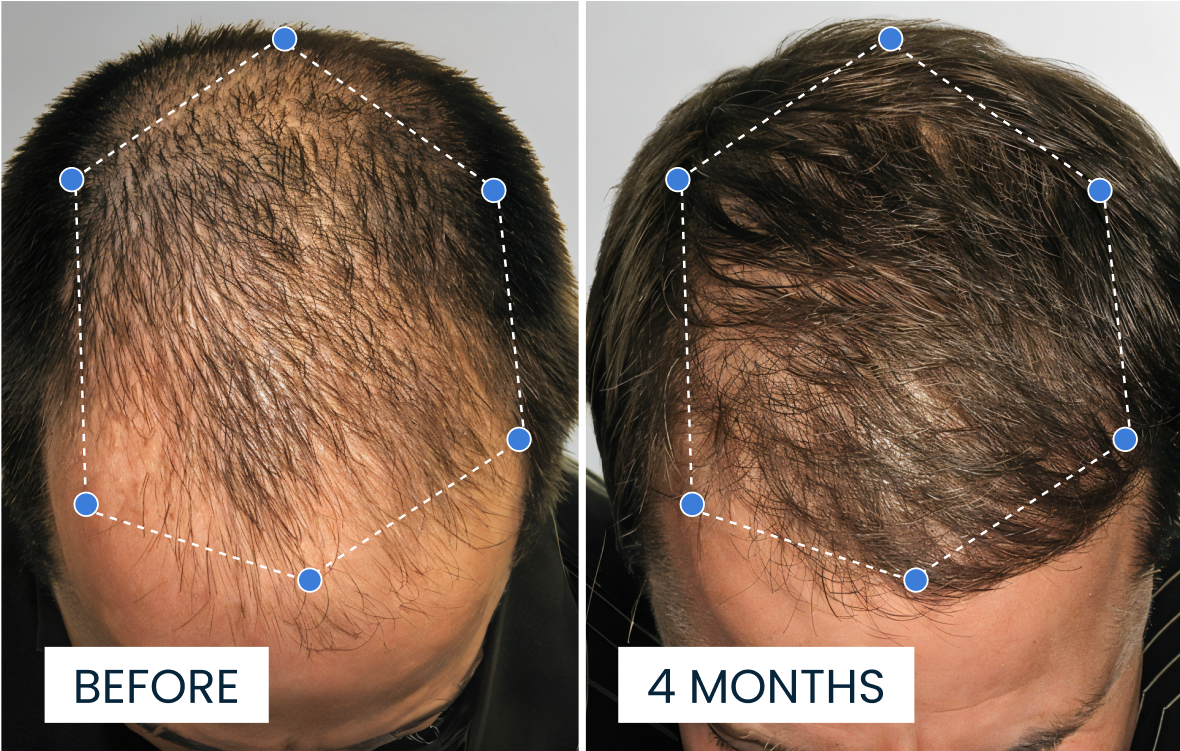 Hair Growth Serum - Roll On