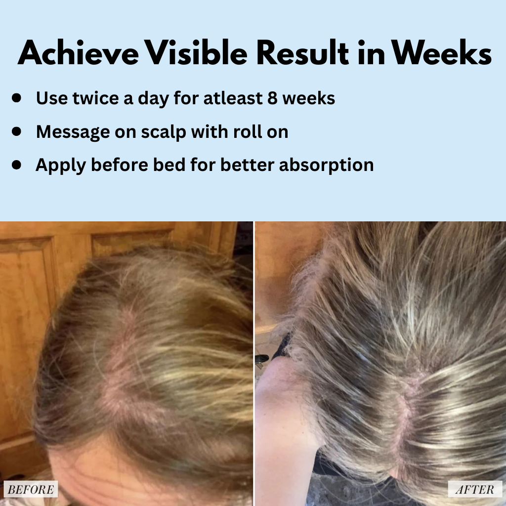 Hair Growth Serum - Roll On