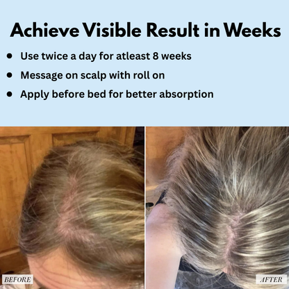 Hair Growth Serum - Roll On