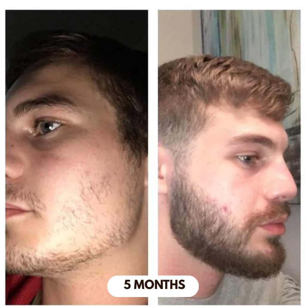 Hair Growth Serum - Roll On
