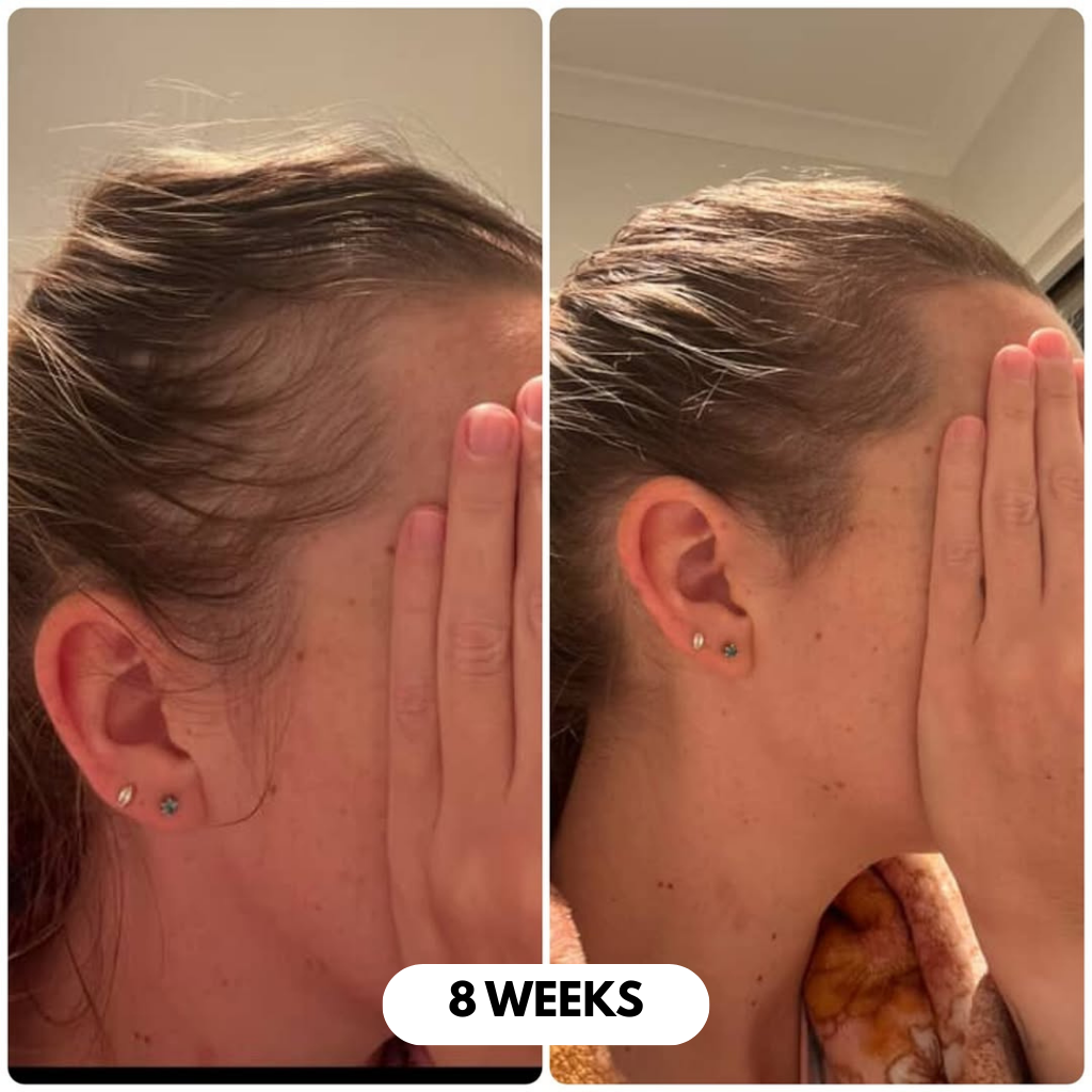 Hair Growth Serum - Roll On