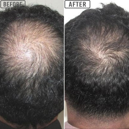 Hair Growth Serum - Roll On